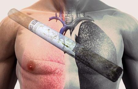 Почему рак поражает только часть курильщиков?