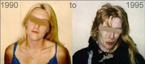 ФОТО наркоманов до и после