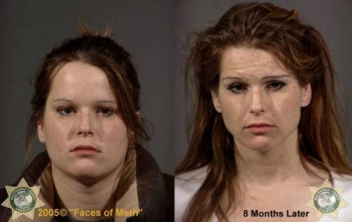 Фотографии наркоманок до и после