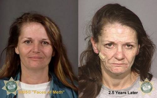 Фото наркоманок до и после