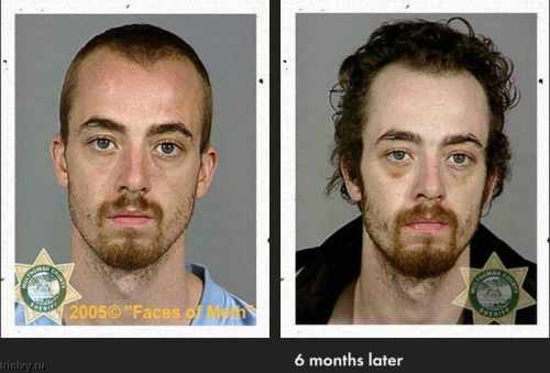 Фото наркоманов до и после