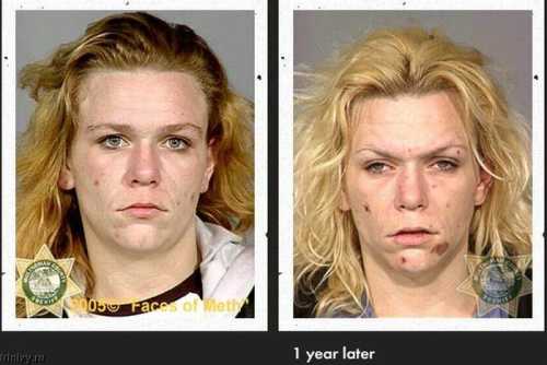 Фото наркоманки до и после